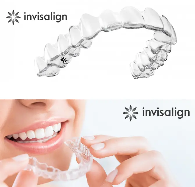 イメージ：矯正中の見た目の不安は？2