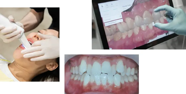 イメージ：インビザライン矯正でまず大切なのは「本当に最適な選択なのか」嘘なく伝えること。1