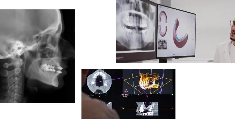 イメージ：インビザライン矯正でまず大切なのは「本当に最適な選択なのか」嘘なく伝えること。2